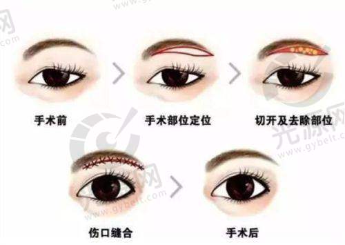 一、深圳禧悦医疗美容门诊部的详细介绍