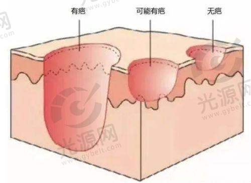 一、林芝去痣的医院榜单前十名单