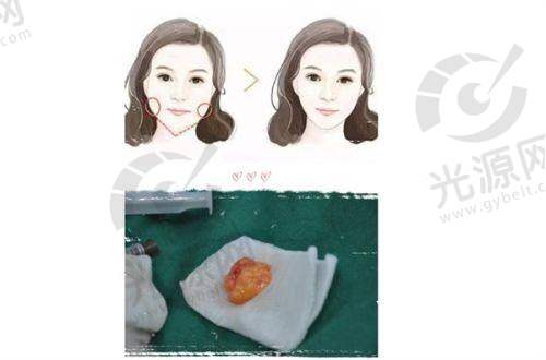 三、珠海科美整形医院实例评价分享