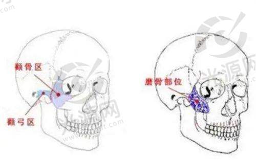 9. 泰国暹罗娜整容医院