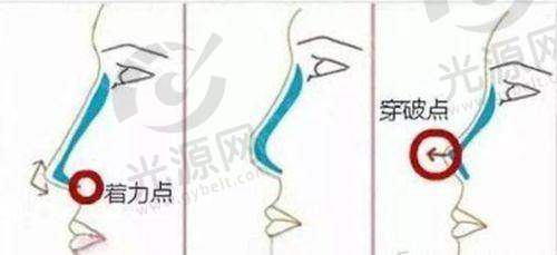 四、成都纽莱茵整形医院地址与预约信息