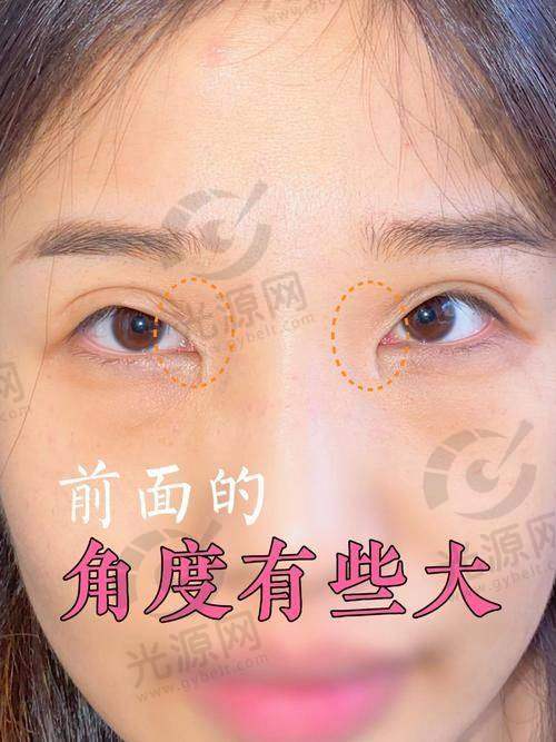 唐爱东医生的收费情况