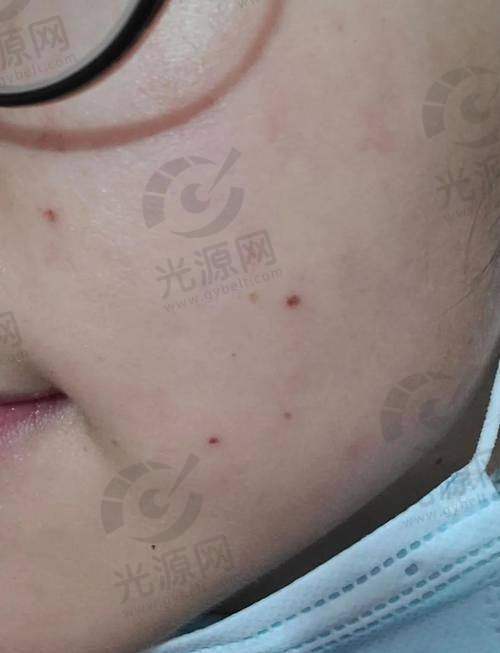 二、林芝去痣的医院每家医院的详细介绍