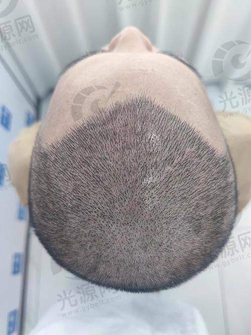 8. 南宁东方整形植发