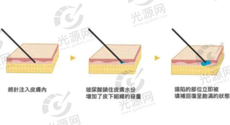 广州高尚医疗美容门诊部项目价格