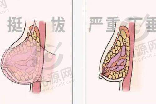 主流超大假体品牌与技术