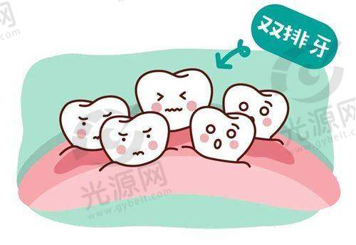 项目实例1: