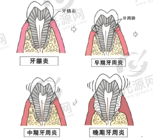 二、深圳地区收费贵吗?