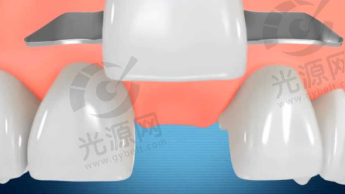 二、拜博口腔医院的种植牙与牙齿矫正技术优势