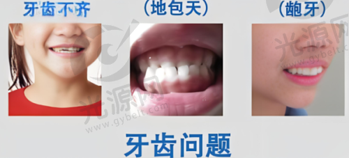 1. 深圳明德牙科医院种植牙价格表