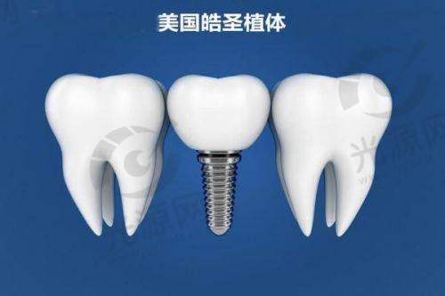 二、中诺第二口腔医院擅长项目及技术优势