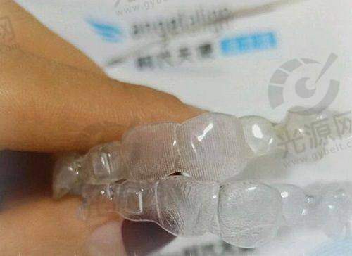 五、上海英博口腔医院预约挂号攻略