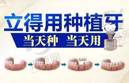 2025上海口腔医院排名前十名推荐，包含拔牙、种植牙服务与联系方式解析