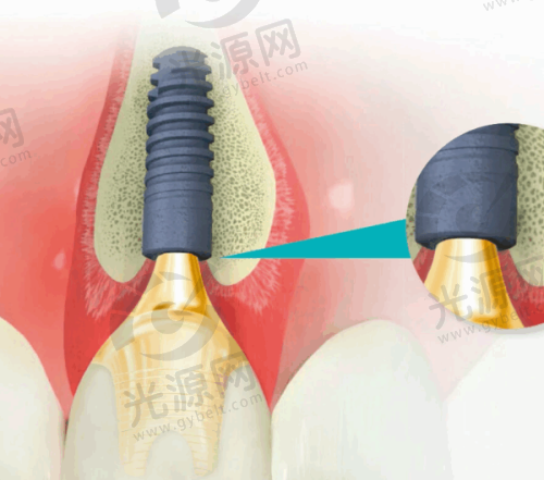 一、上海英博口腔医院地址电话，医院简介与资质