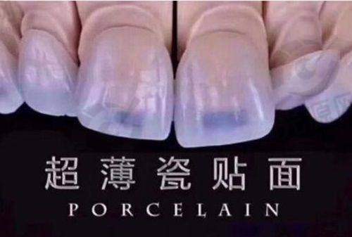总结