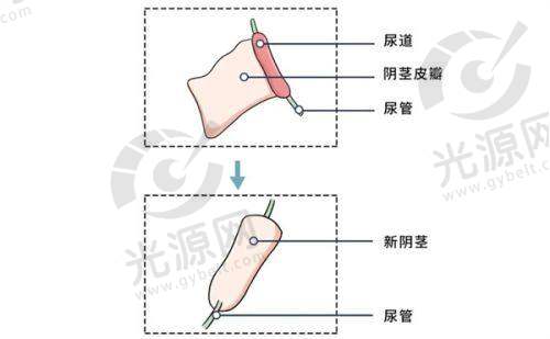推荐的去势手术整形医院