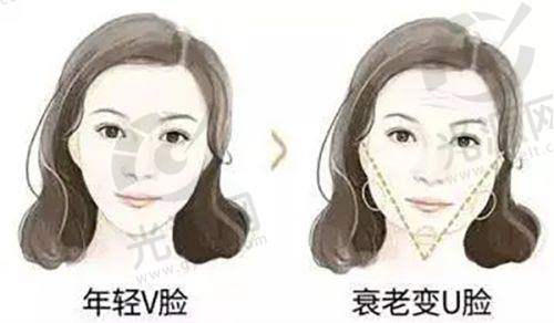 深圳私密整形医院推荐