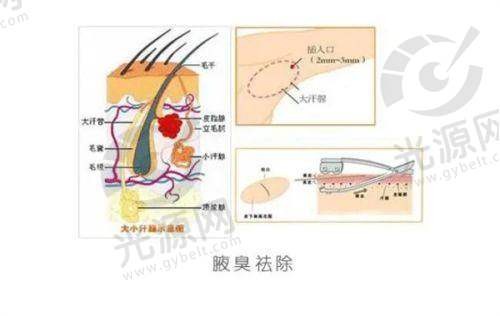 昆明私密整形医院推荐