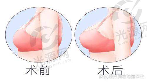 总结：万连壮医生，值得信赖的整形选择