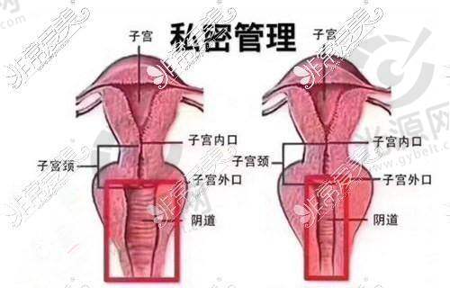 私密八爪鱼紧缩手术的副作用与注意事项