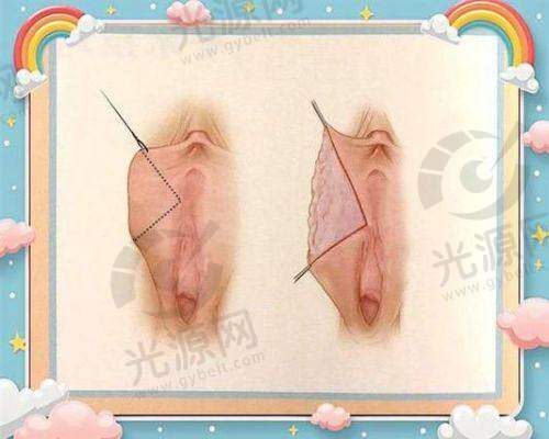 多样化问题解决能力及推荐方案