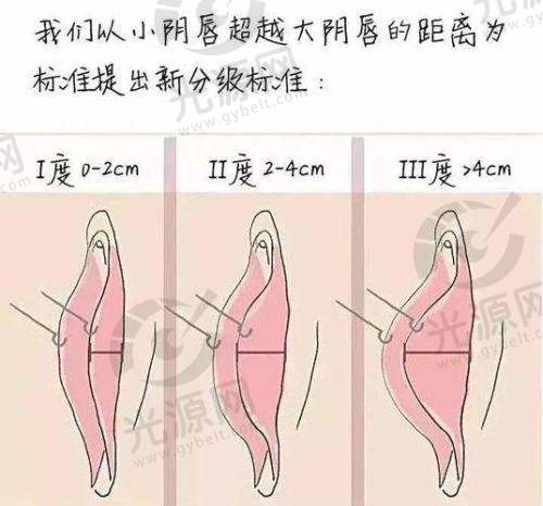 妇科询问在线医生免费：便捷的医疗服务搭建