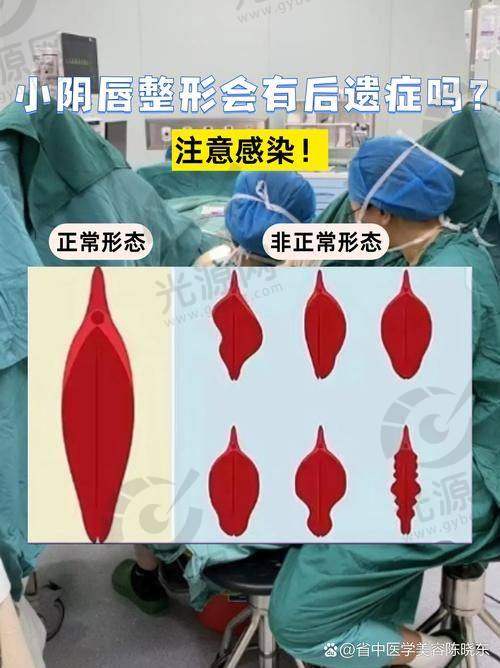 3D生物束带紧缩术术后多久可以同房？