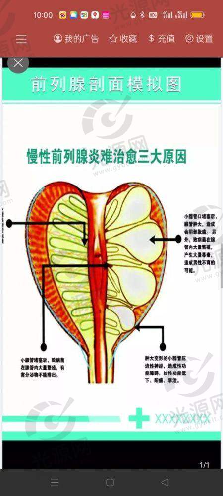 男性入珠手术实图：价格区间解析