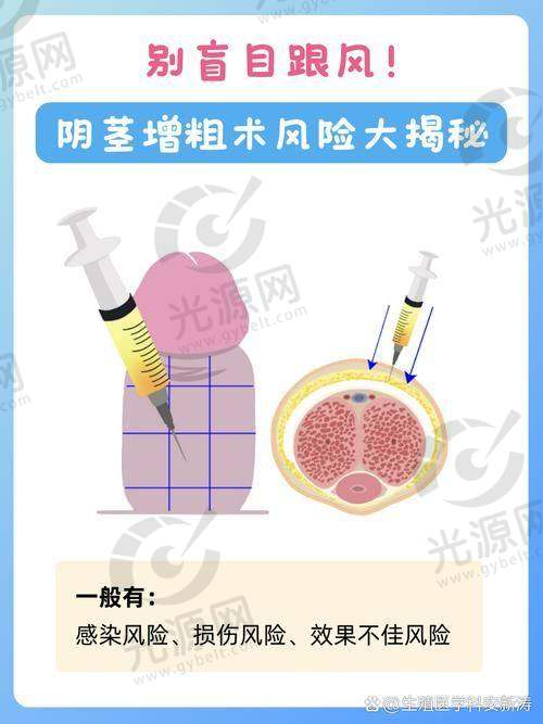 术后护理费与增值服务