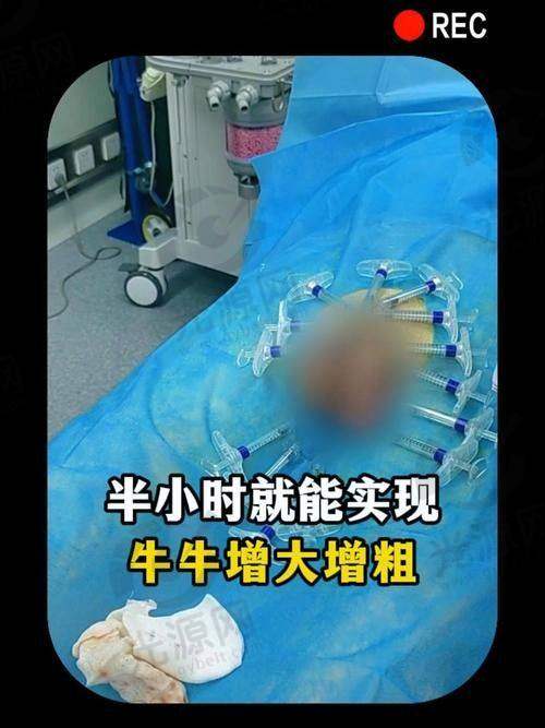 影响阴茎手术价格的因素