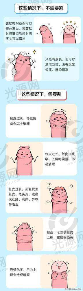 割了包皮多少费用的社会认知与误区