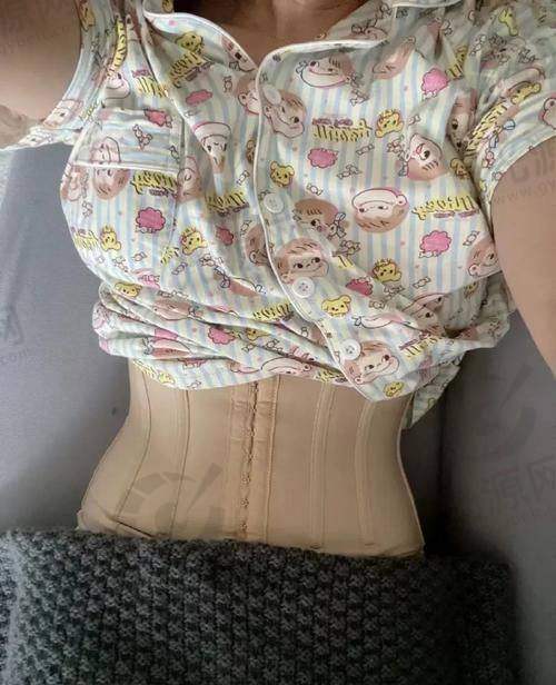 个人体质在大腿52厘米抽脂成效中的角色