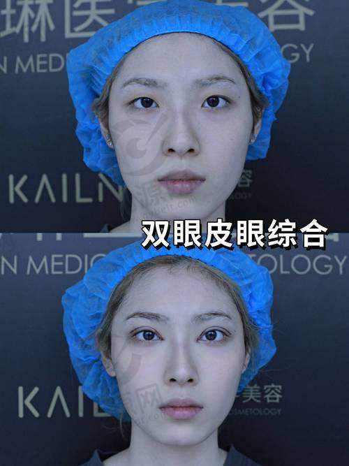 4. 武汉天骄医疗美容医院