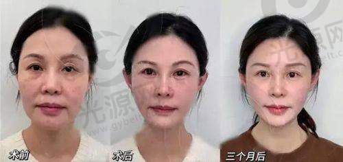 10. 武汉优美医疗美容医院