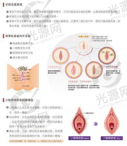 阴蒂太大怎么办，遗传基因的影响