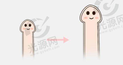 阴茎短小怎么办？心理治疗是不可忽视的一环