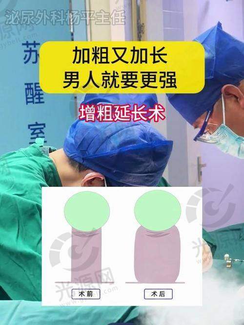 男性增粗增长手术费用揭秘：术后增粗增大多少厘米及可能的风险与后遗症分析