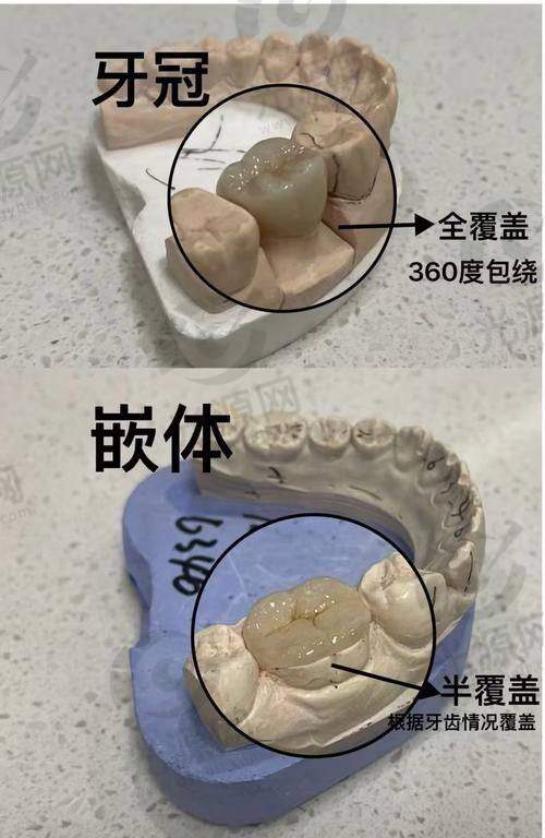 所用材料的成本差异
