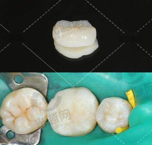 保险与报销政策影响