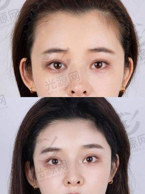 9. 广州华美植发 - 面向大众的优质医疗选择