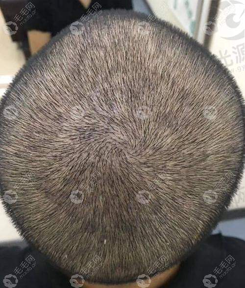 在线预约挂号快捷通道攻略