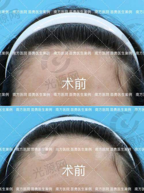 2、北京地区头顶加密种植价格表