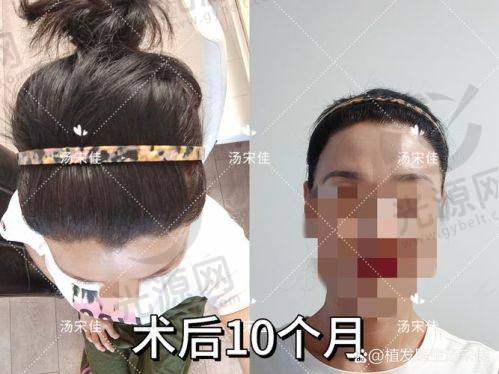 8. 广州荔医植发 - 以人为本的医疗服务