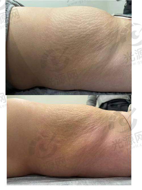 2. 德州妇婴医院整形科
