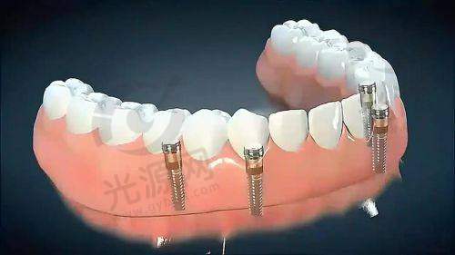 6. 商丘华美口腔医院：技术与美学的结合
