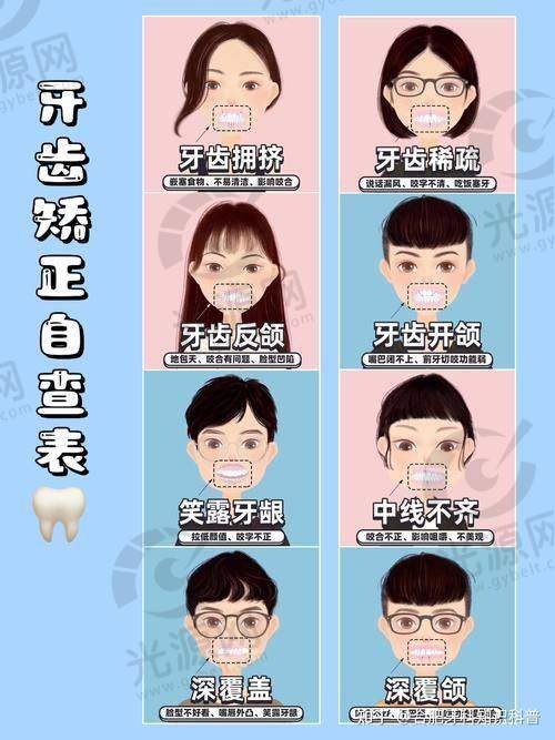 门牙突出更快矫正方法的真实实例