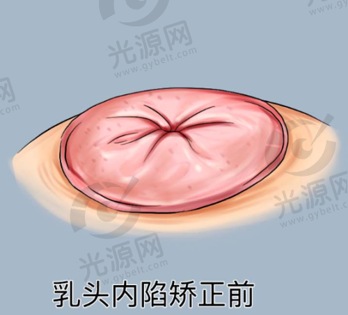 一、邯郸卫校美容整形科——实力派医院的独特魅力