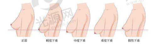 绿毒瘦脸针的安心性分析