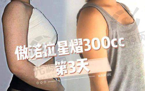 7. 日本素帕整形外科