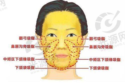 下颌角整形手术的影响